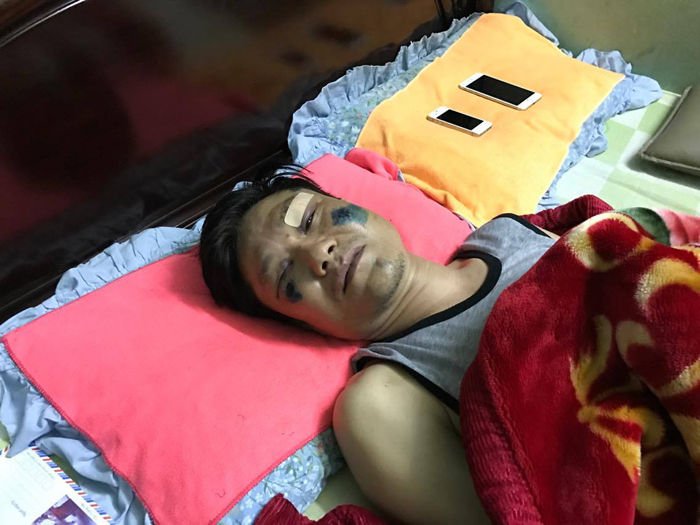Lời kể kinh hoàng của 3 nạn nhân bị đánh oan trong vụ mất trộm xe SH