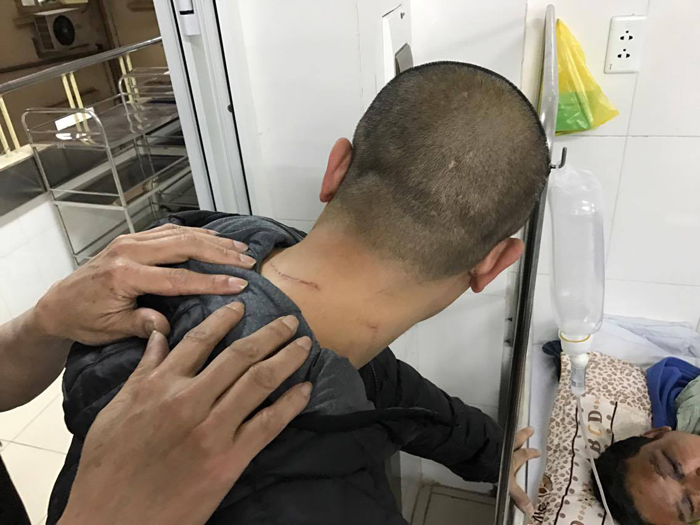 Lời kể kinh hoàng của 3 nạn nhân bị đánh oan trong vụ mất trộm xe SH
