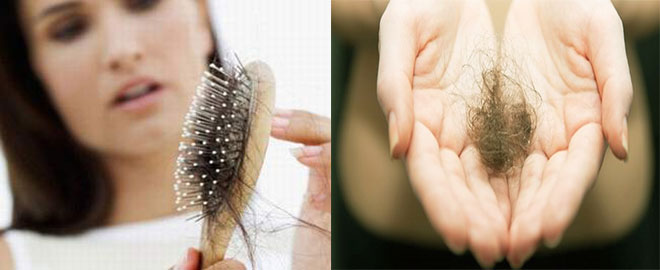Cách chữa rụng tóc cho phụ nữ sau sinh đơn giản mà hiệu quả