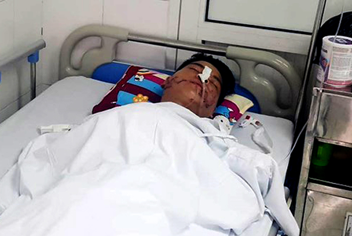 Thông tin tiếp vụ nam diễn viên xiếc bị dập nát mặt khi cho đầu vào miệng cá sấu