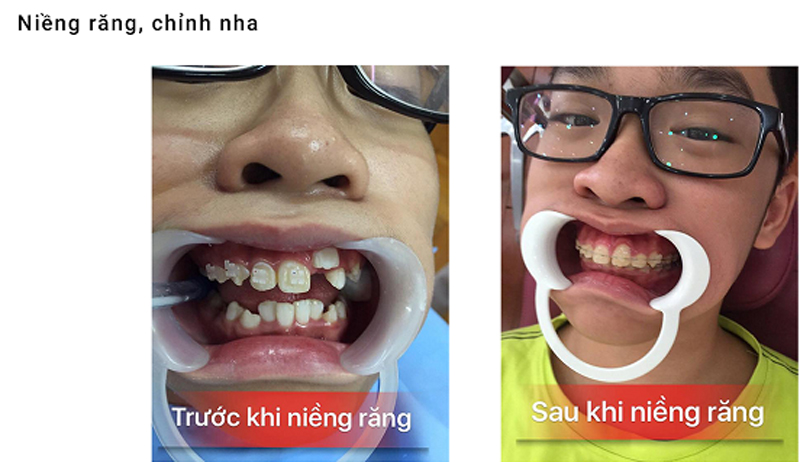 Nha khoa Việt Pháp Hà Nội - Trung tâm Nha khoa tiêu chuẩn Pháp tại Quảng Ninh