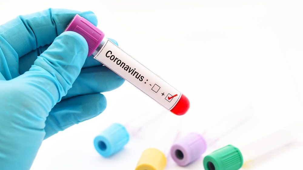 Các nhà khoa học tại đại học Monash phát hiện một loại thuốc có khả năng điều trị virus Corona