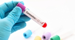 Các nhà khoa học tại đại học Monash phát hiện một loại thuốc có khả năng điều trị virus Corona