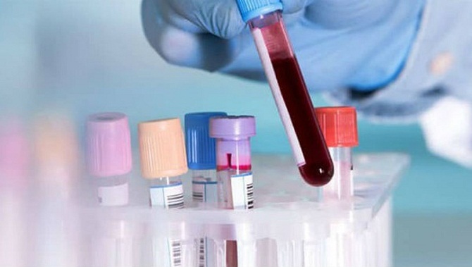 Thực hiện xét nghiệm HIV đúng quy định