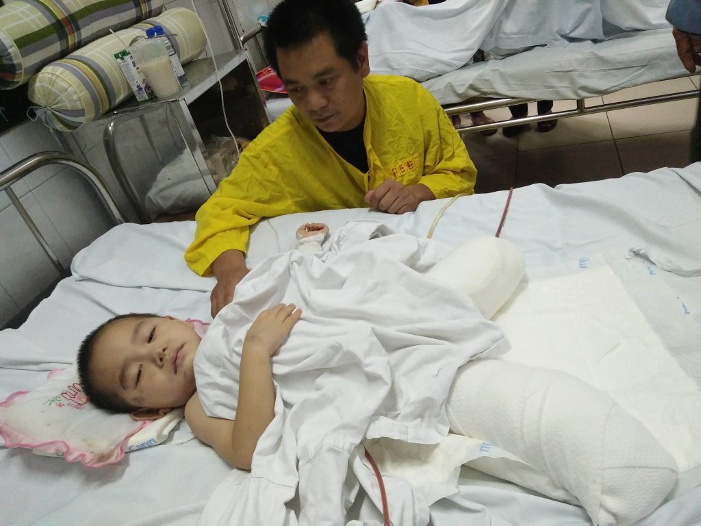 Chung tay giúp đỡ cháu bé 4 tuổi bị đá đè mất đi đôi chân