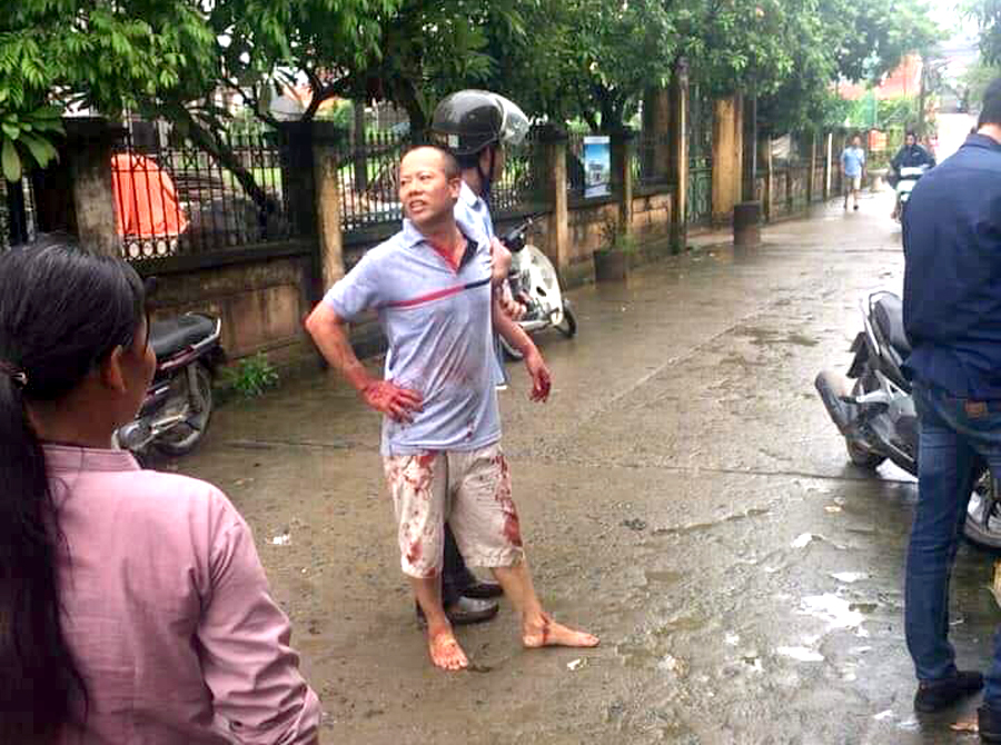 Nghi án tranh chấp đất đai, anh ruột vác dao truy sát cả nhà em trai