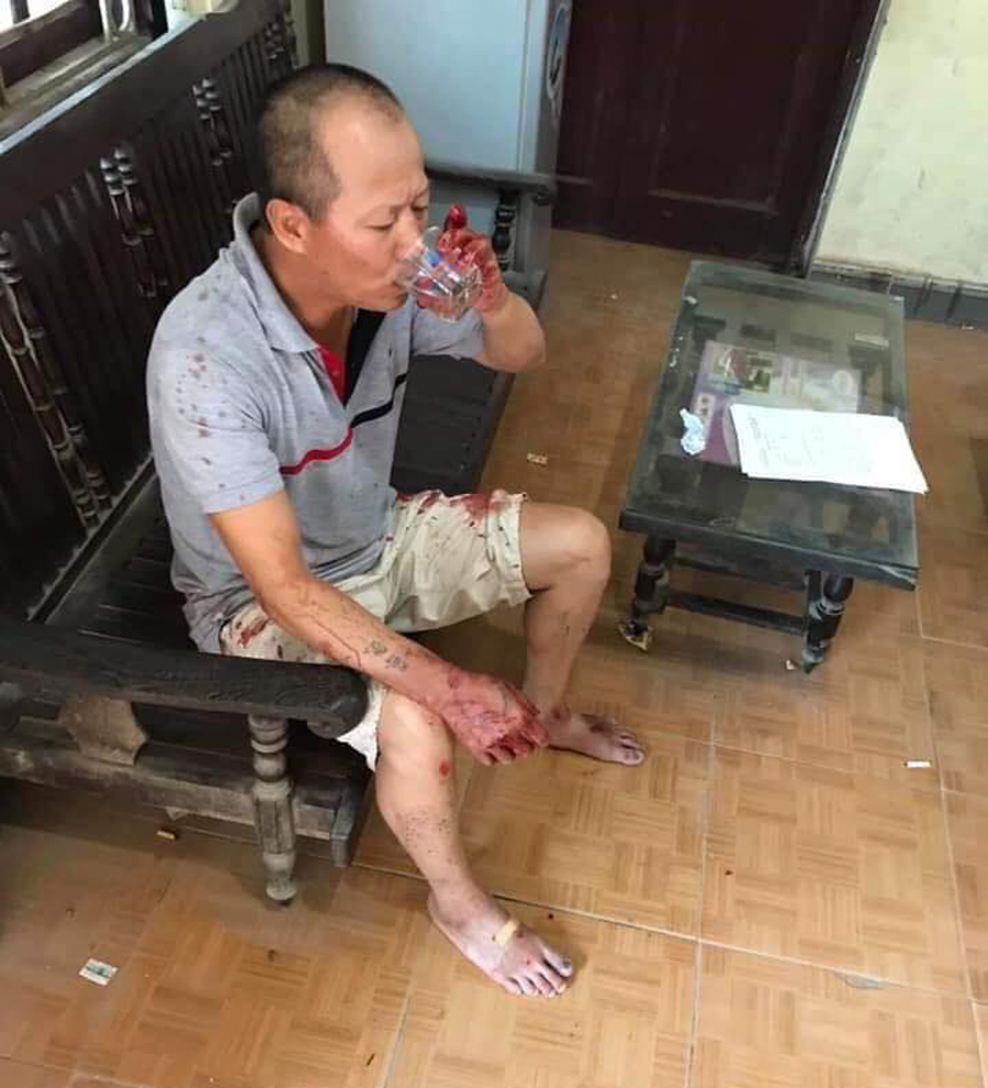 Sau khi gây ra án mạng đặc biệt nghiêm trọng, hung thủ về nhà bình thản ngồi uống nước