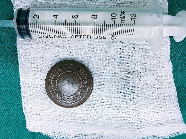 Cụ bà đi cấp cứu vì ngậm