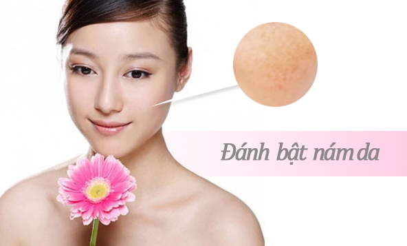 Kem chống nám Tây Thi 